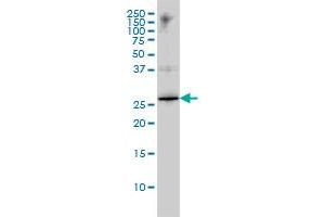 Western Blotting (WB) image for anti-High Mobility Group Box 1 (HMGB1) (AA 1-215) antibody (ABIN561281)