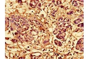 Immunohistochemistry of paraffin-embedded human pancreatic tissue using ABIN7142792 at dilution of 1:100 (RPL28 antibody  (AA 2-137))