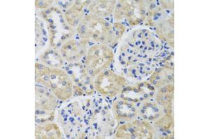 Immunohistochemistry of paraffin-embedded rat kidney using TUBB8 antibody. (Tubulin, beta 8 antibody)