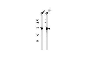Lane 1: HeLa Cell lysates, Lane 2: HL-60Cell lysates, probed with VRK1 (1015CT2. (VRK1 antibody)