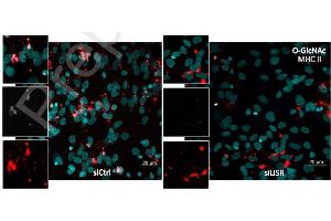 Co-staining for the MHCII (Red) and O-GlcNac (grey) revealed an overlap between the glycosylation signal and the antigen presenting machinery. (MHC Class II HLA-DP/DQ/DR antibody)