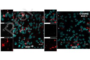 Immunostaining (ISt) image for anti-MHC Class II HLA-DP/DQ/DR (HLA-DP/DQ/DR) antibody (ABIN5067814)