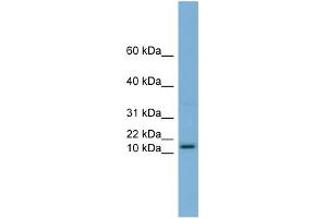 WB Suggested Anti-HRK Antibody Titration:  0. (HRK antibody  (N-Term))