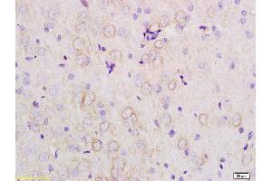 Formalin-fixed and paraffin embedded rat brain tissue labeled with Anti-APOE3 Polyclonal Antibody, Unconjugated (ABIN708761) at 1:200 followed by conjugation to the secondary antibody (APOE antibody  (AA 101-180))
