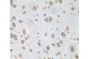 Immunohistochemistry of paraffin-embedded Mouse brain using GNE Polyclonal Antibody at dilution of 1:100 (40x lens). (GNE antibody)