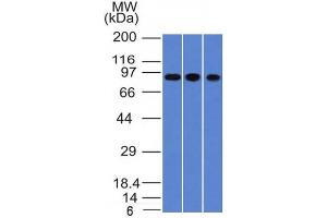 Western Blot of A549, HepG2 & HCT116 cell lysates with Villin Monoclonal Antibody (VIL1/1314). (Villin 1 antibody  (AA 179-311))