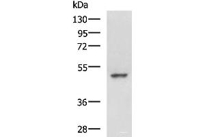Western blot analysis of Hela cell lysate using MYCN Polyclonal Antibody at dilution of 1:800 (MYCN antibody)