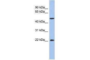 WB Suggested Anti-ANKH Antibody Titration:  0. (ANKH antibody  (N-Term))