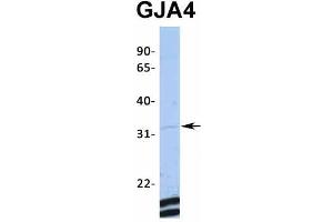 Host:  Rabbit  Target Name:  GJA4  Sample Type:  MCF7  Antibody Dilution:  1. (GJA4 antibody  (Middle Region))