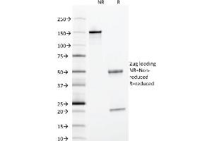 SDS-PAGE Analysis Purified Alpha-1-Antitrypsin Mouse Monoclonal Antibody (AAT/1378). (SERPINA1 antibody)