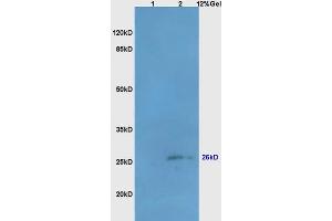 Lane 1: mouse liver lysates Lane 2: mouse brain lysates probed with Anti Bcl-10/CLAP/CIPER Polyclonal Antibody, Unconjugated (ABIN749828) at 1:200 in 4 °C.