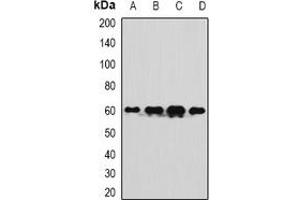 Western blot analysis of TUG expression in SW480 (A), A549 (B), mouse liver (C), mouse testis (D) whole cell lysates. (ASPSCR1 antibody)