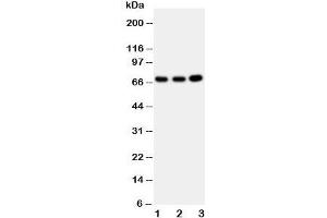 Western blot testing of GBP1 antibody and Lane 1:  U87;  2: HeLa;  3: MCF-7 cell lysate (GBP1 antibody  (AA 566-589))