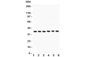 Western blot testing of Heme Oxygenase 2 antibody and Lane 1:  rat kidney;  2: human A549;  3: (h) COLO320;  4: (h) MM231;  5: (h) HeLa;  6: (h) SKOV. (HMOX2 antibody  (AA 2-316))