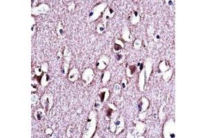 LMO2 antibody immunohistochemistry analysis in formalin fixed and paraffin embedded human brain tissue. (LMO2 antibody  (AA 1-30))