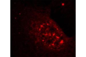 Immunofluorescence staining of methanol-fixed Hela cells showing nuclear dot staining using Phospho-AKT1-T308 antibody. (AKT1 antibody  (pThr308))