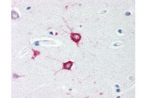 Anti-TOLLIP antibody IHC of human brain, cortex.