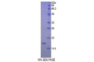 SDS-PAGE (SDS) image for Renalase, FAD-Dependent Amine Oxidase (RNLS) protein (His tag) (ABIN1880142)