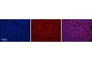 Rabbit Anti-ABHD14A Antibody  Catalog Number: ARP67926_P050 Formalin Fixed Paraffin Embedded Tissue: Human Adult Liver  Observed Staining: Cytoplasm in hepatocytes, strong signal, wide tissue distribution Primary Antibody Concentration: 1:100 Secondary Antibody: Donkey anti-Rabbit-Cy3 Secondary Antibody Concentration: 1:200 Magnification: 20X Exposure Time: 0. (ABHD14A antibody  (C-Term))