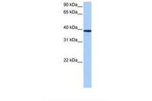 Image no. 1 for anti-Mitochondrial rRNA Methyltransferase 1 Homolog (MRM1) (AA 254-303) antibody (ABIN6737965) (MRM1 antibody  (AA 254-303))