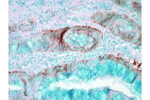 Immunohistochemistry analysis using Rabbit Anti-HSP70 Polyclonal Antibody . (HSP70 antibody  (PerCP))