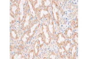 Immunohistochemistry of paraffin-embedded Mouse kidney using HMGA1 Polyclonal Antibody at dilution of 1:100 (40x lens). (HMGA1 antibody)