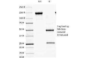 SDS-PAGE Analysis Purified MALT1 Mouse Monoclonal Antibody (MT1/410). (MALT1 antibody  (AA 701-808))