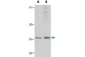 Western blot analysis of RSPO1 in rat spleen tissue lysate with RSPO1 polyclonal antibody  at (A) 1 and (B) 2 ug/mL . (RSPO1 antibody  (N-Term))