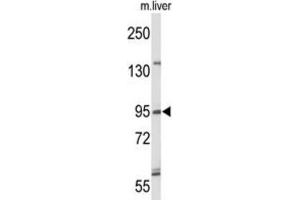 Western Blotting (WB) image for anti-Gen Endonuclease Homolog 1 (GEN1) antibody (ABIN3004202)