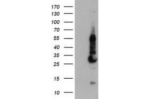 HEK293T cells were transfected with the pCMV6-ENTRY control (Left lane) or pCMV6-ENTRY KCNJ3 (Right lane) cDNA for 48 hrs and lysed. (KCNJ3 antibody  (AA 279-501))