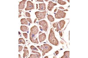 Paraformaldehyde-fixed, paraffin embedded human heart tissue, Antigen retrieval by boiling in sodium citrate buffer (pH6. (MYO18B antibody)