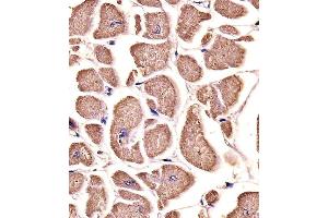 MYO18B antibody