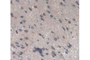 Used in DAB staining on fromalin fixed paraffin- embedded Kidney tissue (Recoverin antibody  (AA 2-200))