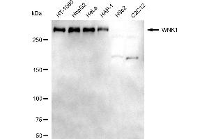 anti-WNK Lysine Deficient Protein Kinase 1 (WNK1) antibody