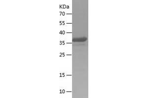 Western Blotting (WB) image for Mitochondrial Antiviral Signaling Protein (MAVS) (AA 379-516) protein (His-IF2DI Tag) (ABIN7283629) (MAVS Protein (AA 379-516) (His-IF2DI Tag))