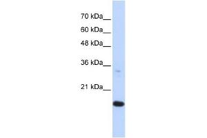 GABARAPL1 antibody used at 1 ug/ml to detect target protein.