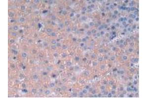 IHC-P analysis of Rat Adrenal Gland Tissue, with DAB staining. (IL12A antibody  (AA 23-215))