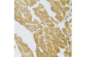 Immunohistochemistry of paraffin-embedded rat heart using SYK Antibody (ABIN5971150) at dilution of 1/100 (40x lens). (SYK antibody)