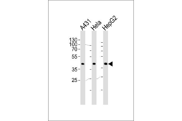 CSNK2A1/CK II alpha antibody  (AA 250-284)