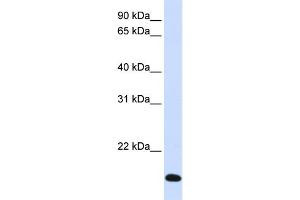 WB Suggested Anti-RNF185 Antibody Titration:  0. (RNF185 antibody  (Middle Region))