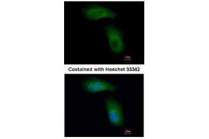 ICC/IF Image Immunofluorescence analysis of methanol-fixed A549, using TRIM36, antibody at 1:500 dilution. (TRIM36 antibody  (C-Term))