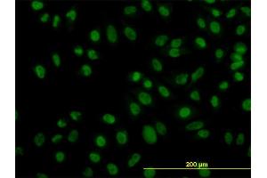 Immunofluorescence of monoclonal antibody to ZNF143 on HeLa cell. (ZNF143 antibody  (AA 1-626))
