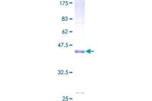 DCTN3 Protein (AA 1-176) (GST tag)