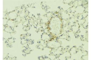 ABIN6268893 at 1/100 staining Human lung tissue by IHC-P. (Integrin beta 4 antibody  (C-Term))