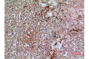 Immunohistochemistry (IHC) analysis of paraffin-embedded Human Liver, antibody was diluted at 1:100. (CD42b antibody  (Internal Region))