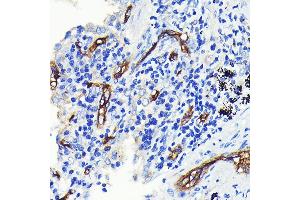 Immunohistochemistry (IHC) image for anti-CD34 (CD34) antibody (ABIN7266187)