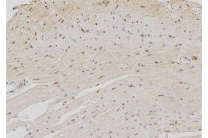 ABIN6259132 and ABIN6273372 at 1/100 staining Rat heart tissue by IHC-P. (NOC4L antibody  (Internal Region))