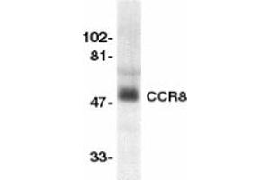Image no. 1 for anti-Chemokine (C-C Motif) Receptor 8 (CCR8) (AA 183-201) antibody (ABIN201969) (CCR8 antibody  (AA 183-201))