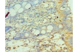 Immunohistochemistry of paraffin-embedded human colon tissue using ABIN7159067 at dilution of 1:100 (MMP14 antibody  (AA 260-540))
