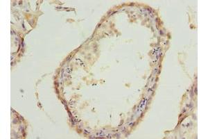 Immunohistochemistry of paraffin-embedded human testis tissue using ABIN7175778 at dilution of 1:100 (WDR61 antibody  (AA 2-305))